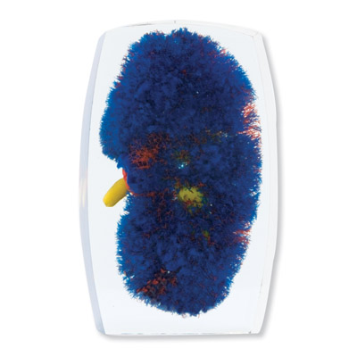 �IѪ��ģ�ͣ��t���S���{��