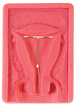 �m�ȱ���������ģ��