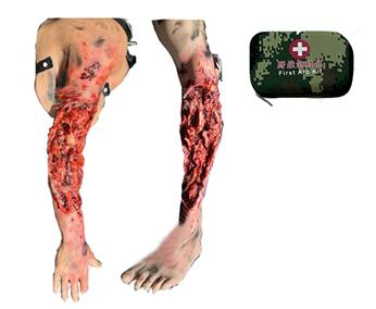 ����ʽ��ѪֹѪģ�MӖ(x��n)����(��֫����֫��